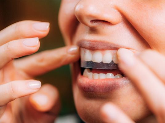 Woman using teeth whitening strips