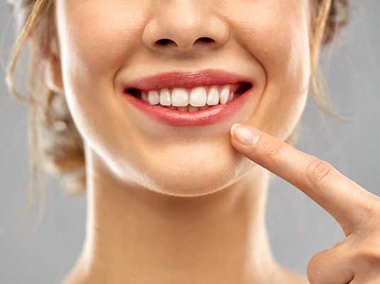 Closeup of woman pointing to her dental implants in Arlington