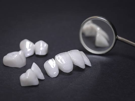 Metal-free restorations and dental mirror.