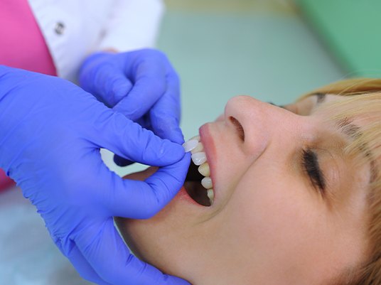 woman getting veneers