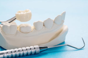 Dental mold and model of a crown